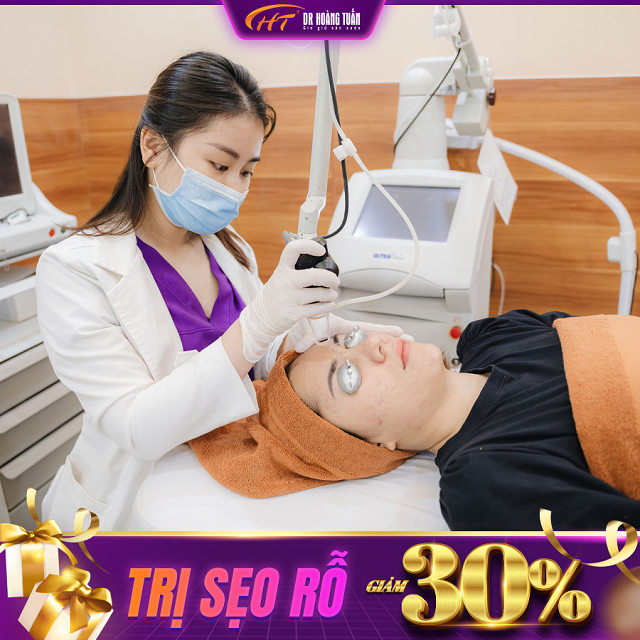 Trị sẹo rỗ giảm 30%